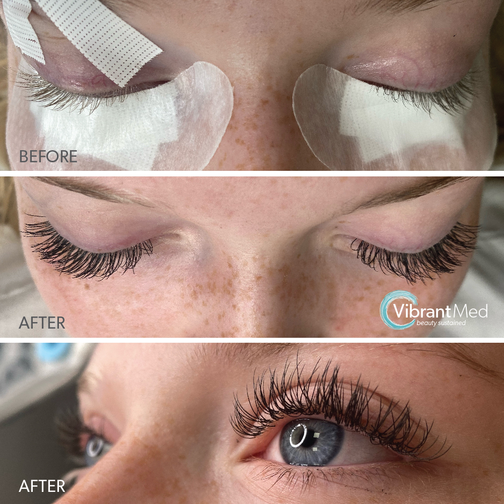 LashesBeforeandAfter 02