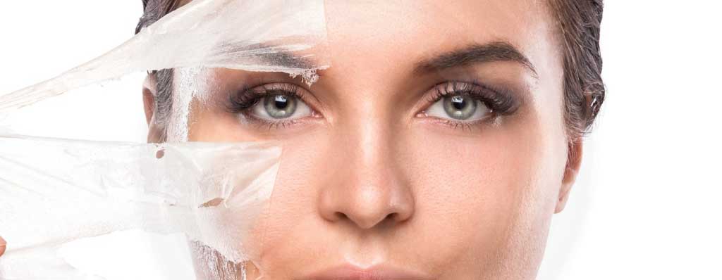 What is a Chemical Peel?